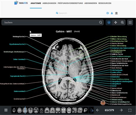 e anatomy imaios|imaios free brain anatomy.